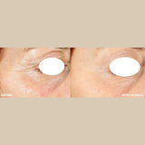 Plump & Protect Bundle Freezeframe