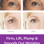 Plump & Protect Bundle Freezeframe