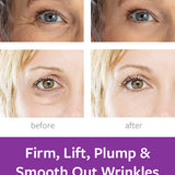 Plump & Protect Bundle Freezeframe