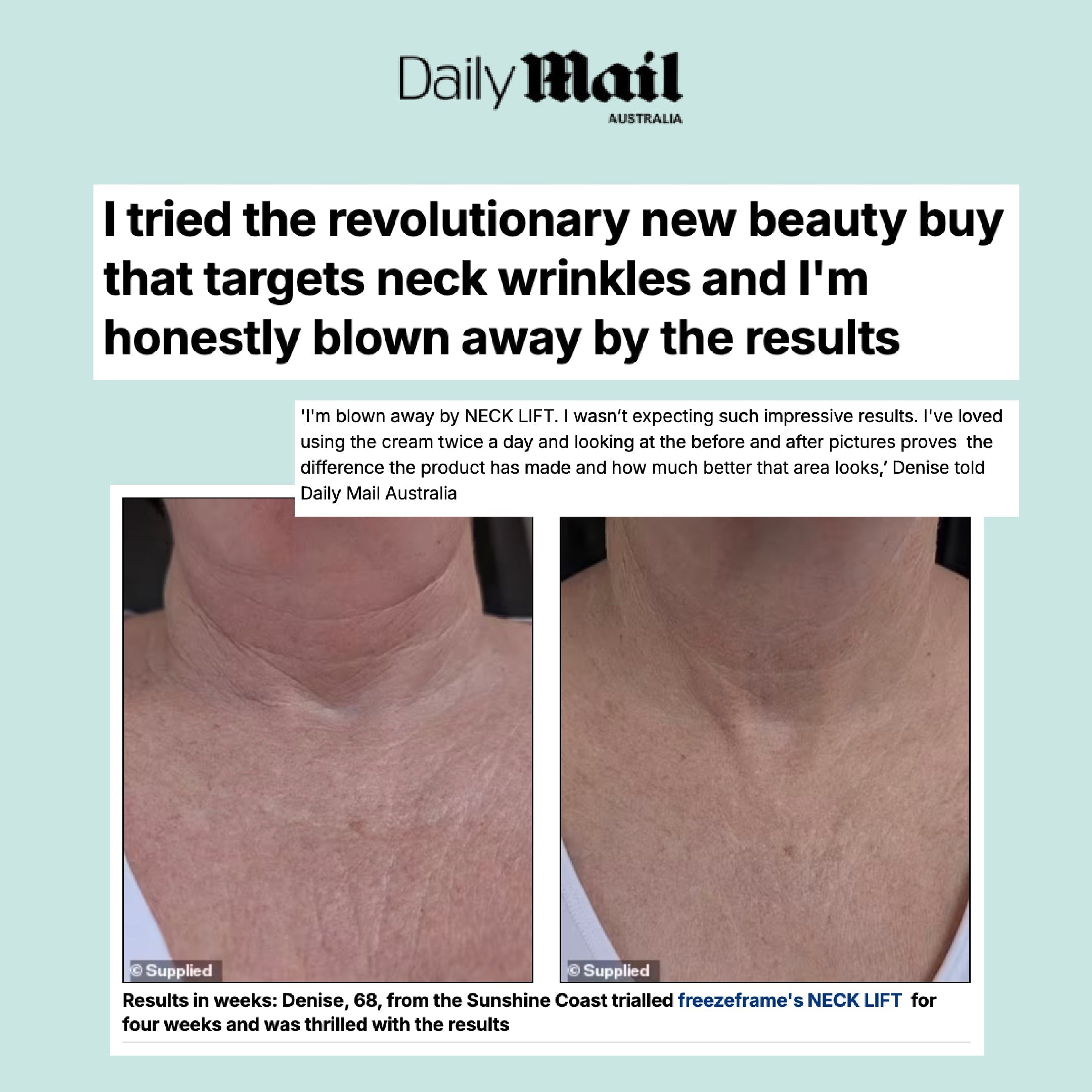NECK LIFT as Featured on Daily Mail
