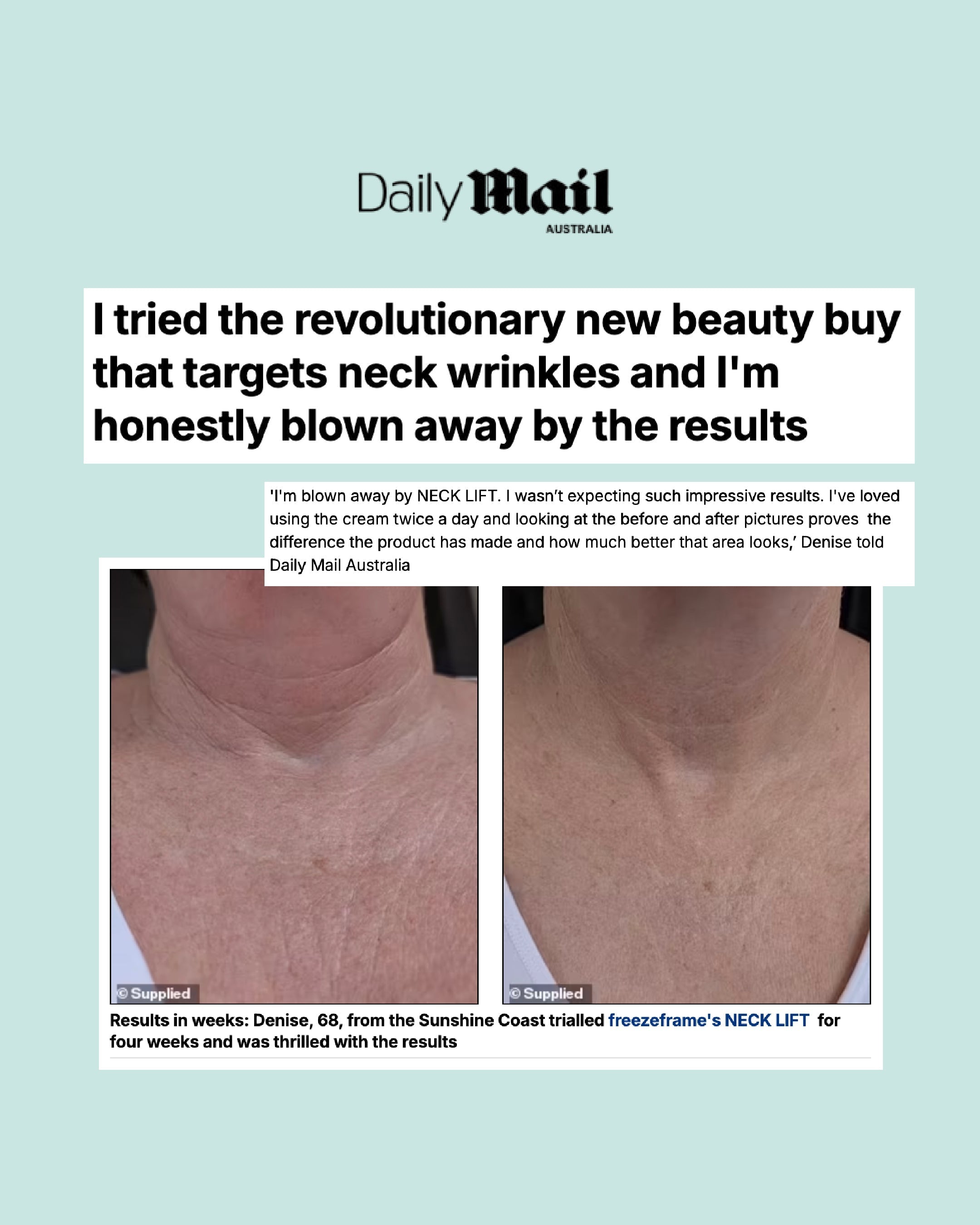 NECK LIFT as Featured on Daily Mail