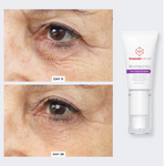Total Eye Repair Bundle freezeframe