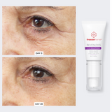 Total Eye Repair Bundle freezeframe