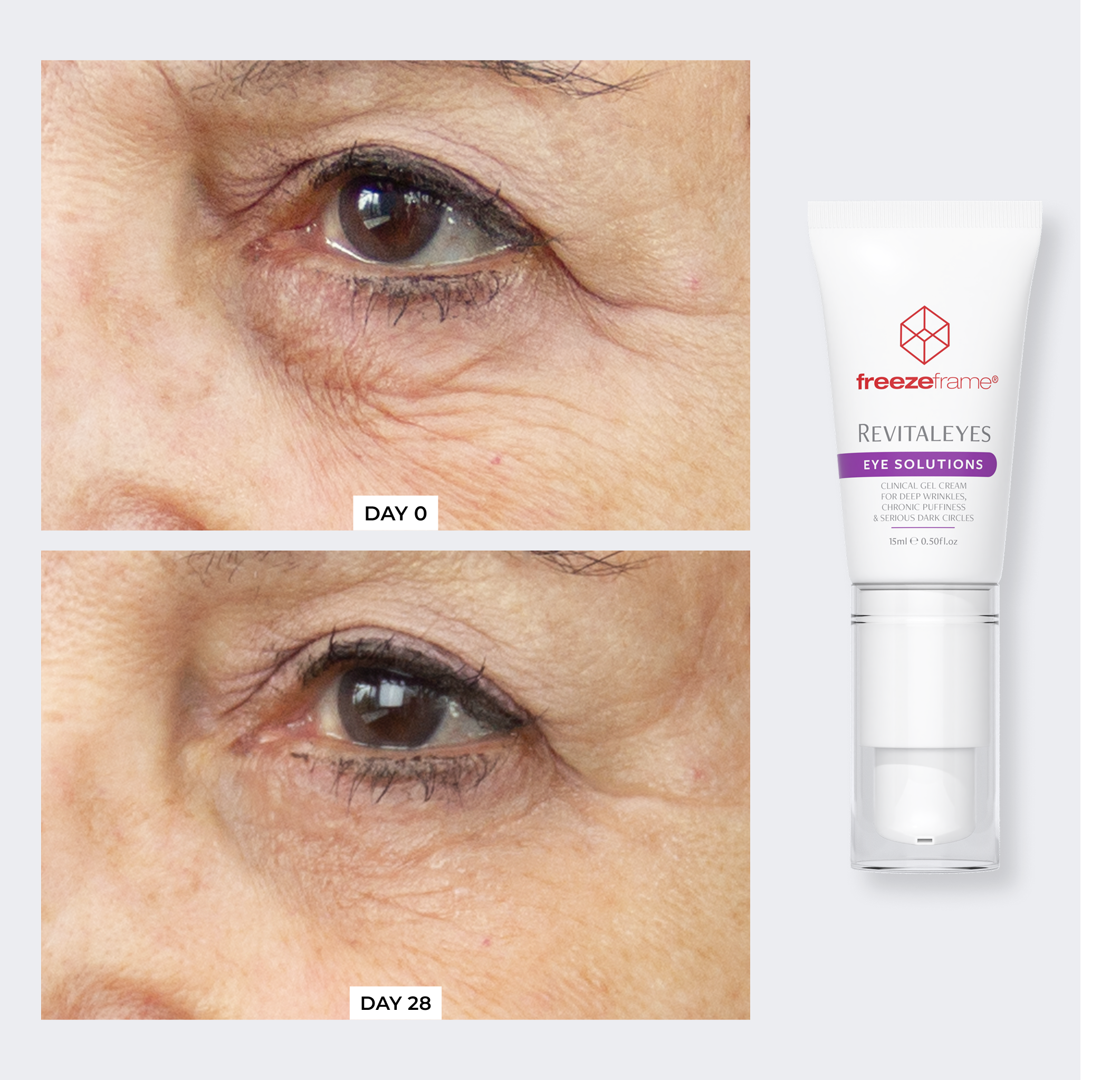 Total Eye Repair Bundle freezeframe