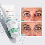 FREEZE WRINKLES WITHOUT BOTOX® freezeframe