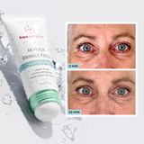 FREEZE WRINKLES WITHOUT BOTOX® freezeframe