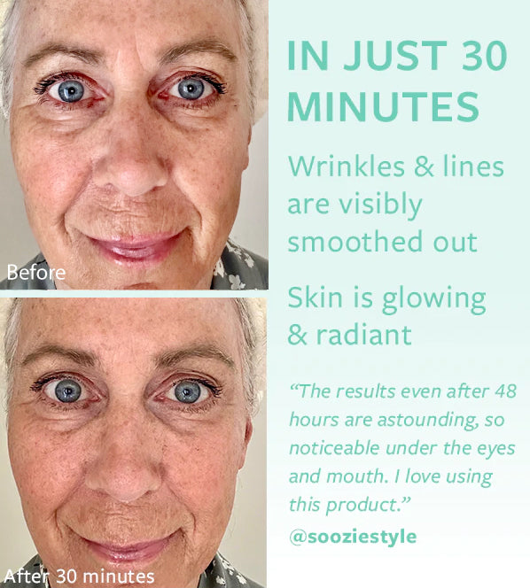 48 HOUR WRINKLE FREEZE ICE ROLLER MASK Self Care Corporation Pty Ltd