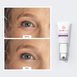 Wrinkle Smoothing & Firming Bundle freezeframe