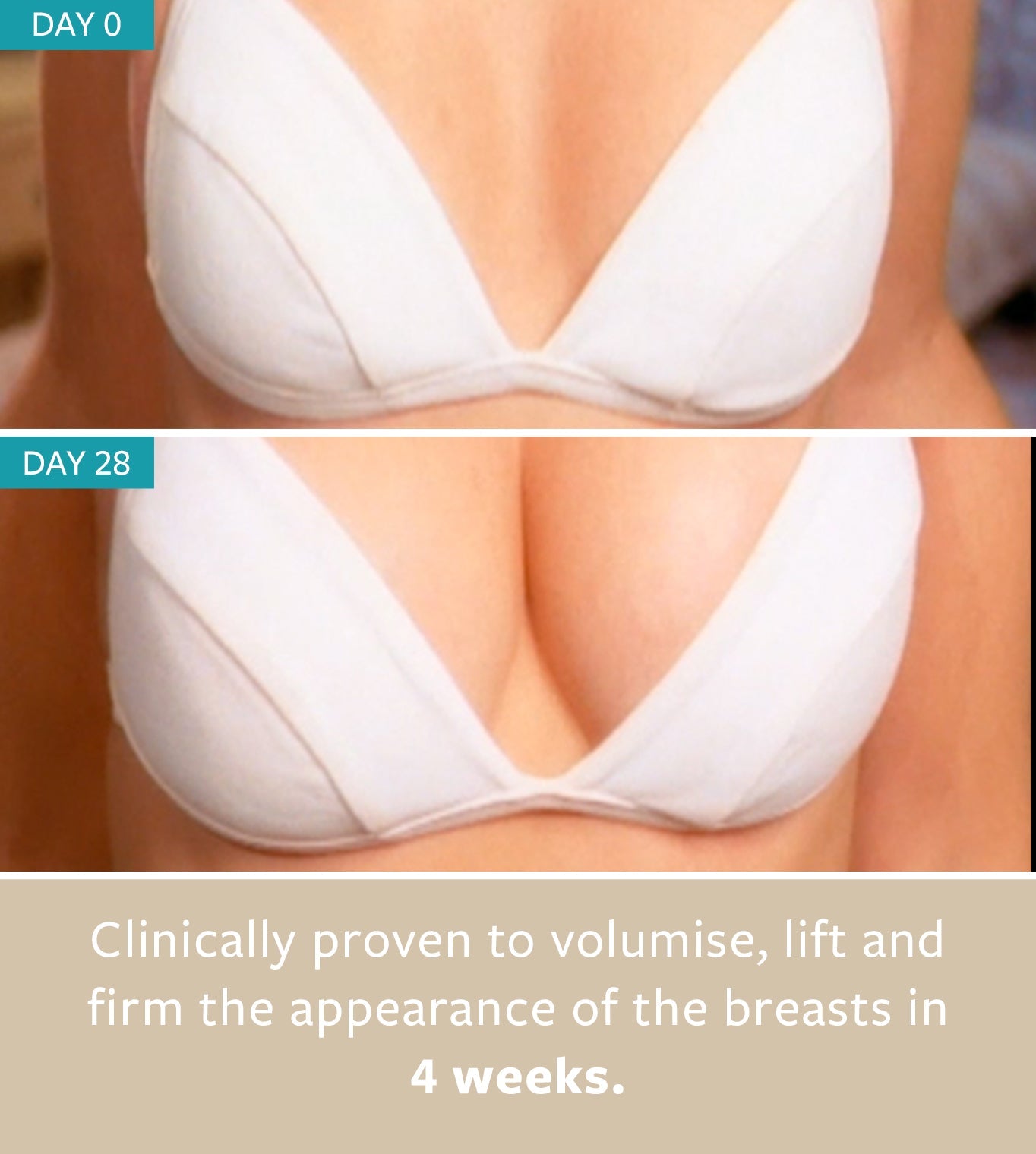 freezeframe BREAST ENHANCER before and after results showing visible volume, lift and firmness in the appearance of the breasts