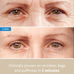INHIBOX freezeframeau