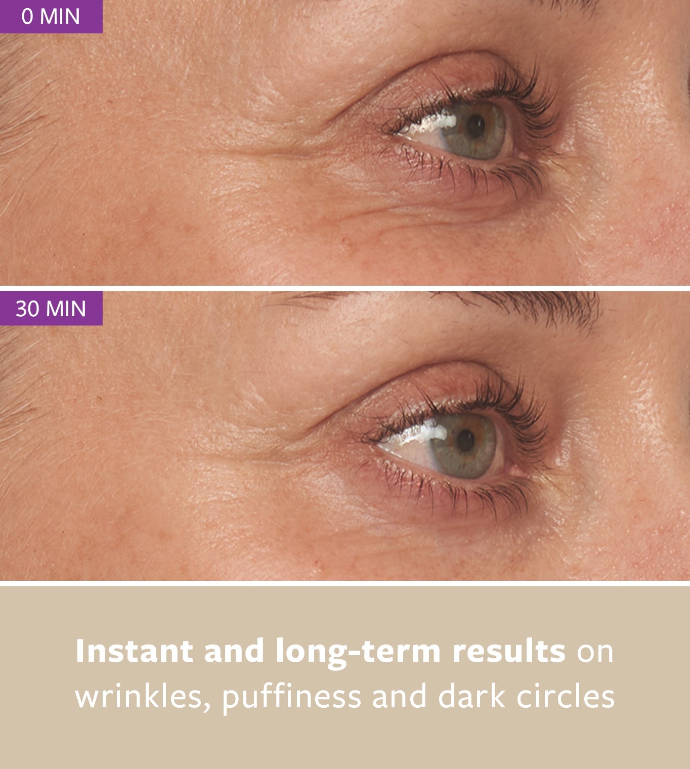 REVITALEYES freezeframeau