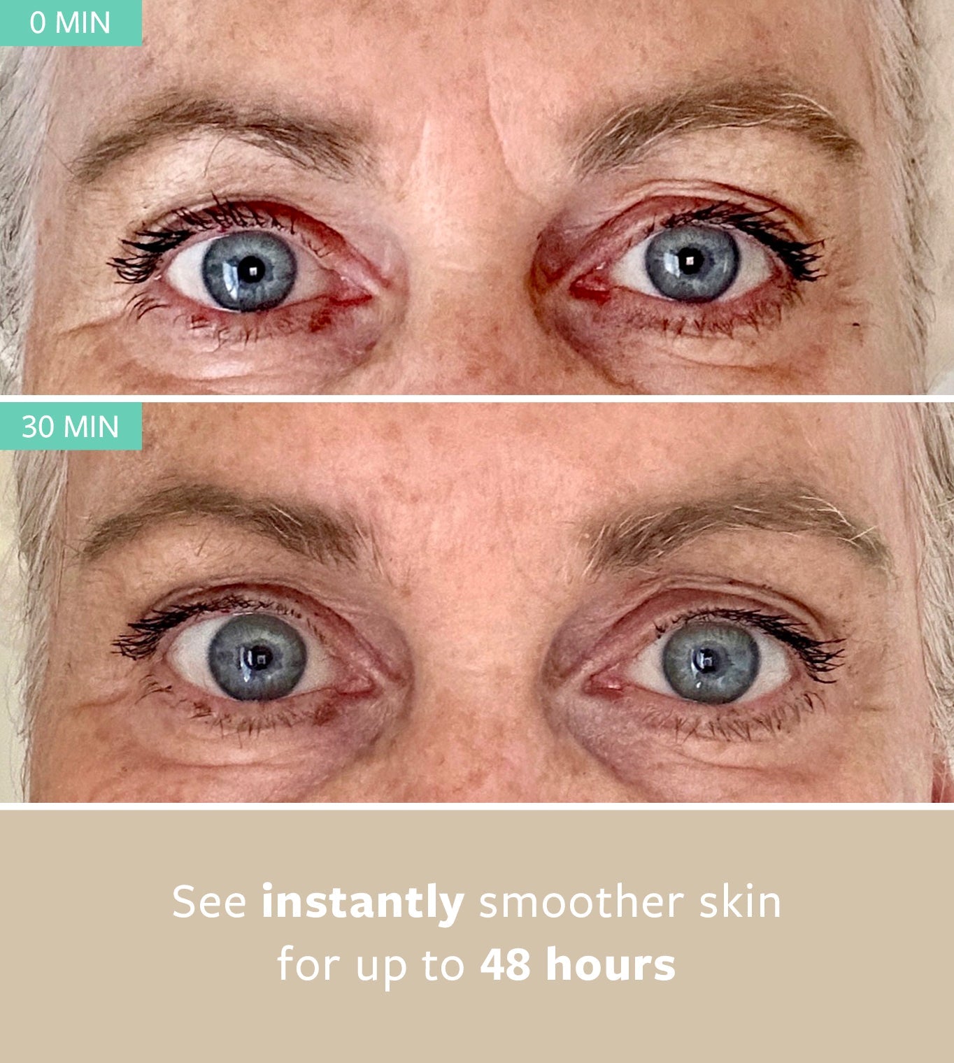 WRINKLE FREEZING BUNDLE - Exclusive TVC Offer freezeframeau
