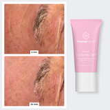 FACE LIFT & REJUVENATION SYSTEM freezeframe