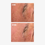 freezeframe Instant EXOSOME LIFT before and after showing visible wrinkle smoothing after 30 minutes