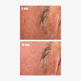 freezeframe Instant EXOSOME LIFT before and after showing visible wrinkle smoothing after 30 minutes