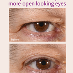 Total Eye Repair Bundle Freezeframe