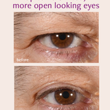 Total Eye Repair Bundle Freezeframe