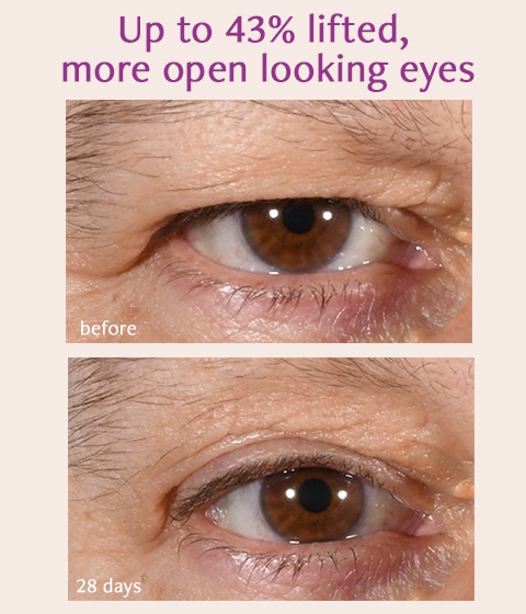 Total Eye Repair Bundle Freezeframe