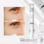 FREEZE WRINKLES WITHOUT BOTOX® freezeframe