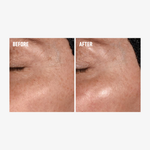 freezeframe Instant EXOSOME LIFT before and after showing smoother, more radiant, reflective glass skin