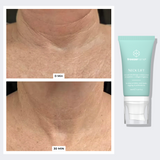 NECK LIFT & WRINKLE RESET SYSTEM freezeframe