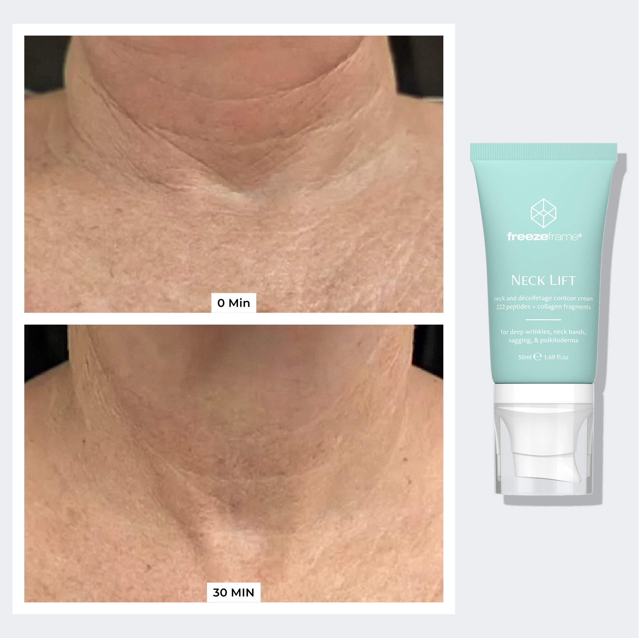 NECK LIFT & WRINKLE RESET SYSTEM freezeframe