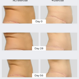 TUMMY TUCK DUO freezeframe