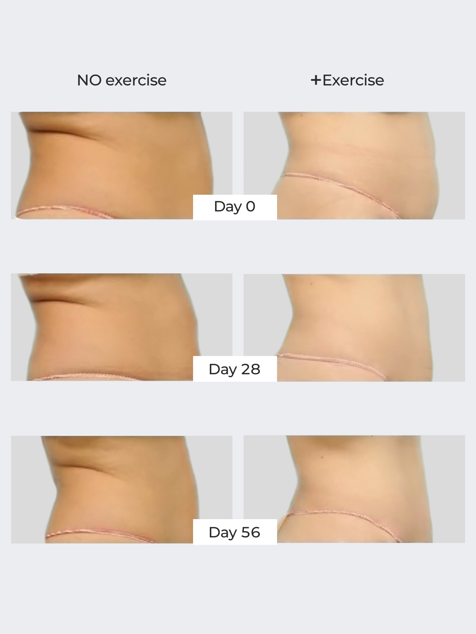 TUMMY TUCK DUO freezeframe