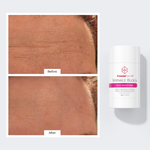 NECK LIFT & WRINKLE RESET SYSTEM freezeframe