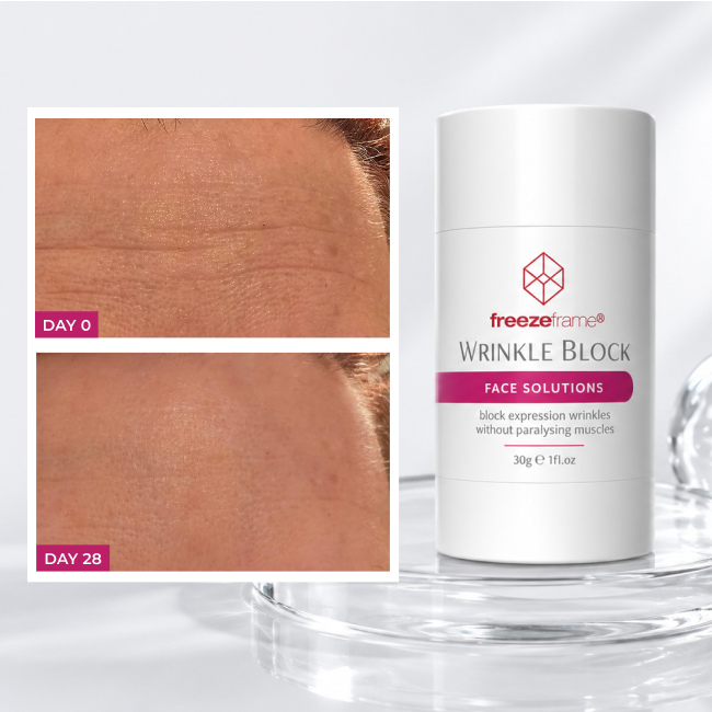 FREEZE WRINKLES WITHOUT BOTOX® freezeframe