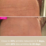 freezeframe WRINKLE BLOCK before and after results showing visible reduction in wrinkles and smoother, younger-looking skin