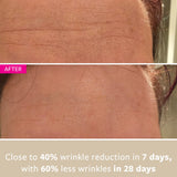freezeframe WRINKLE BLOCK before and after results showing visible reduction in wrinkles and smoother, younger-looking skin