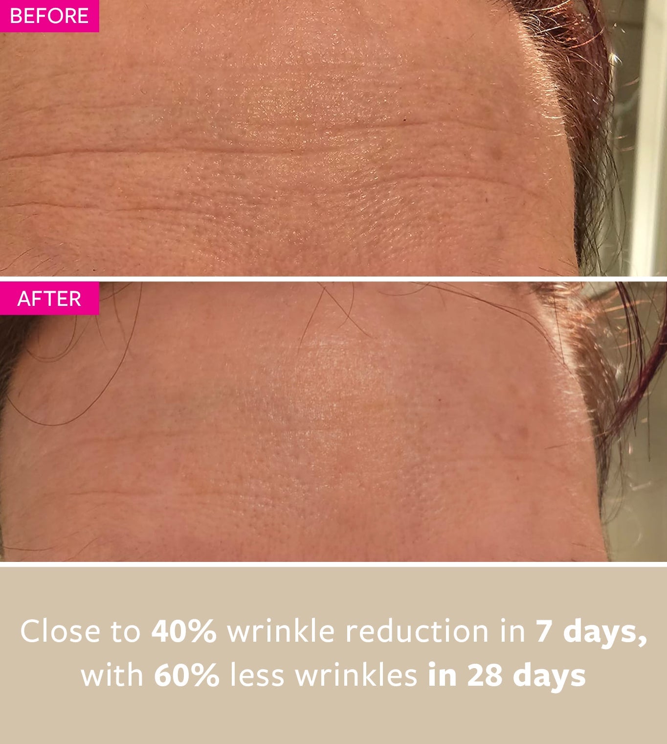 freezeframe WRINKLE BLOCK before and after results showing visible reduction in wrinkles and smoother, younger-looking skin