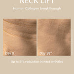 NECK LIFT Freezeframe
