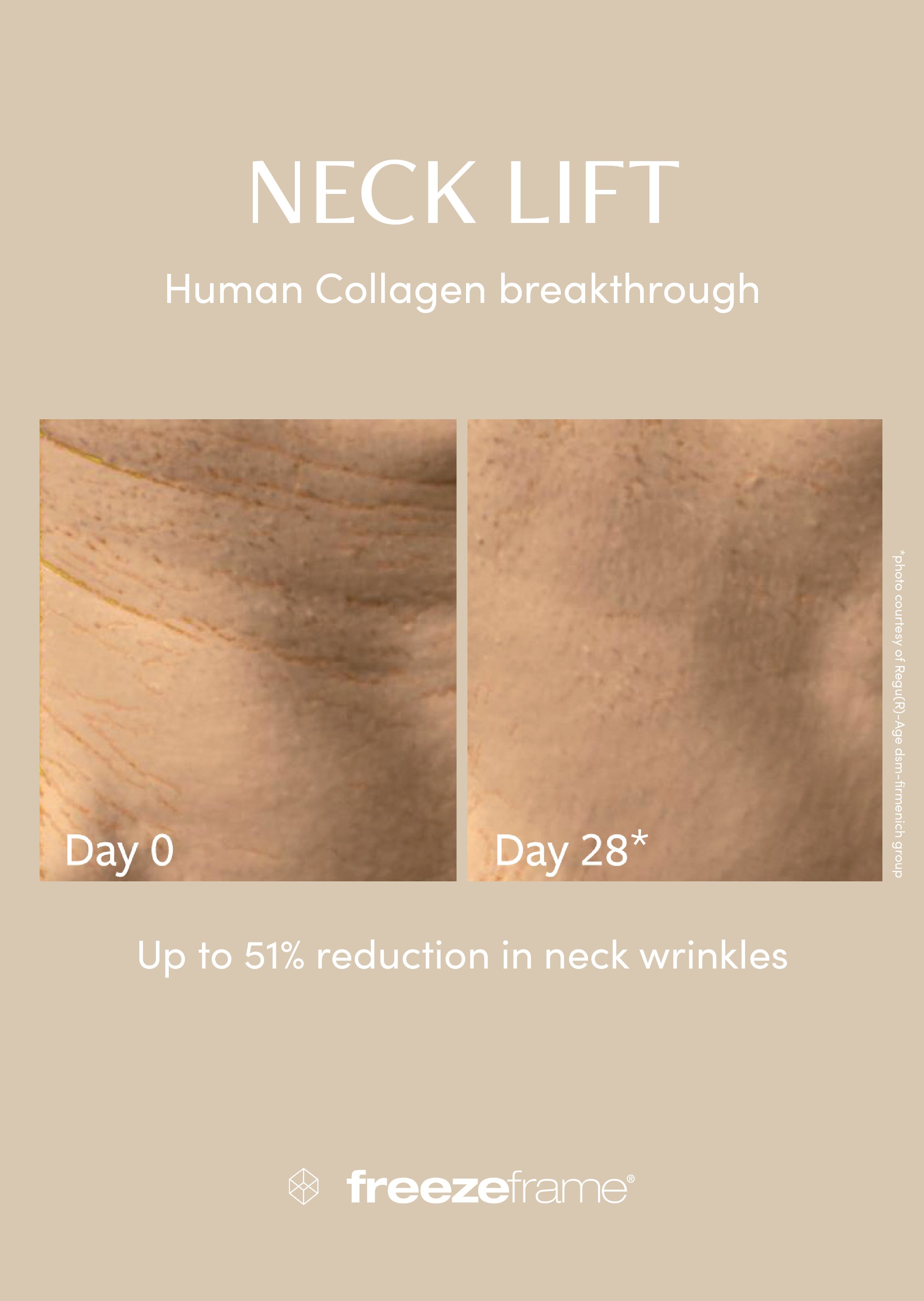 NECK LIFT Freezeframe