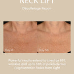 NECK LIFT Freezeframe