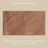 NECK LIFT Freezeframe