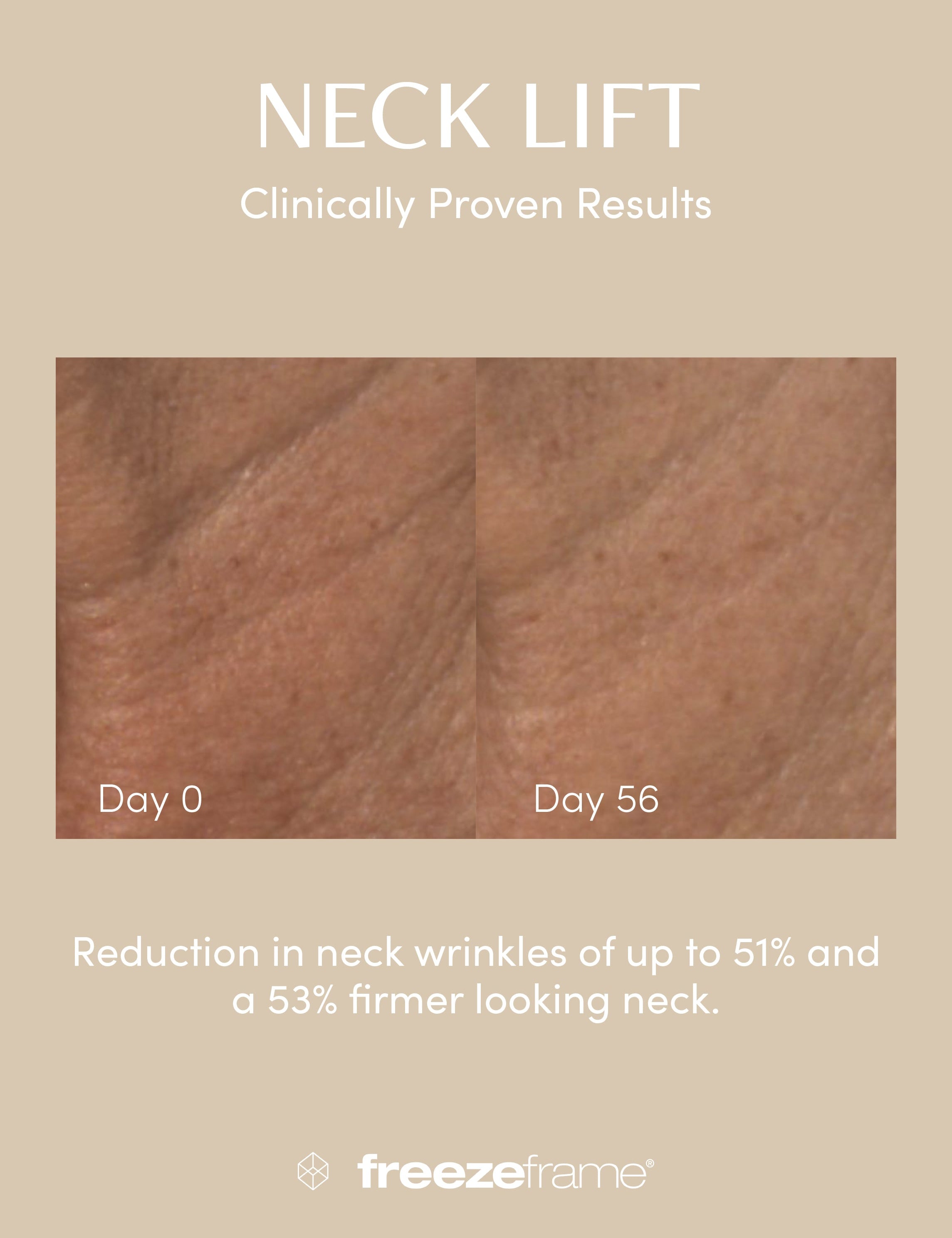 NECK LIFT Freezeframe