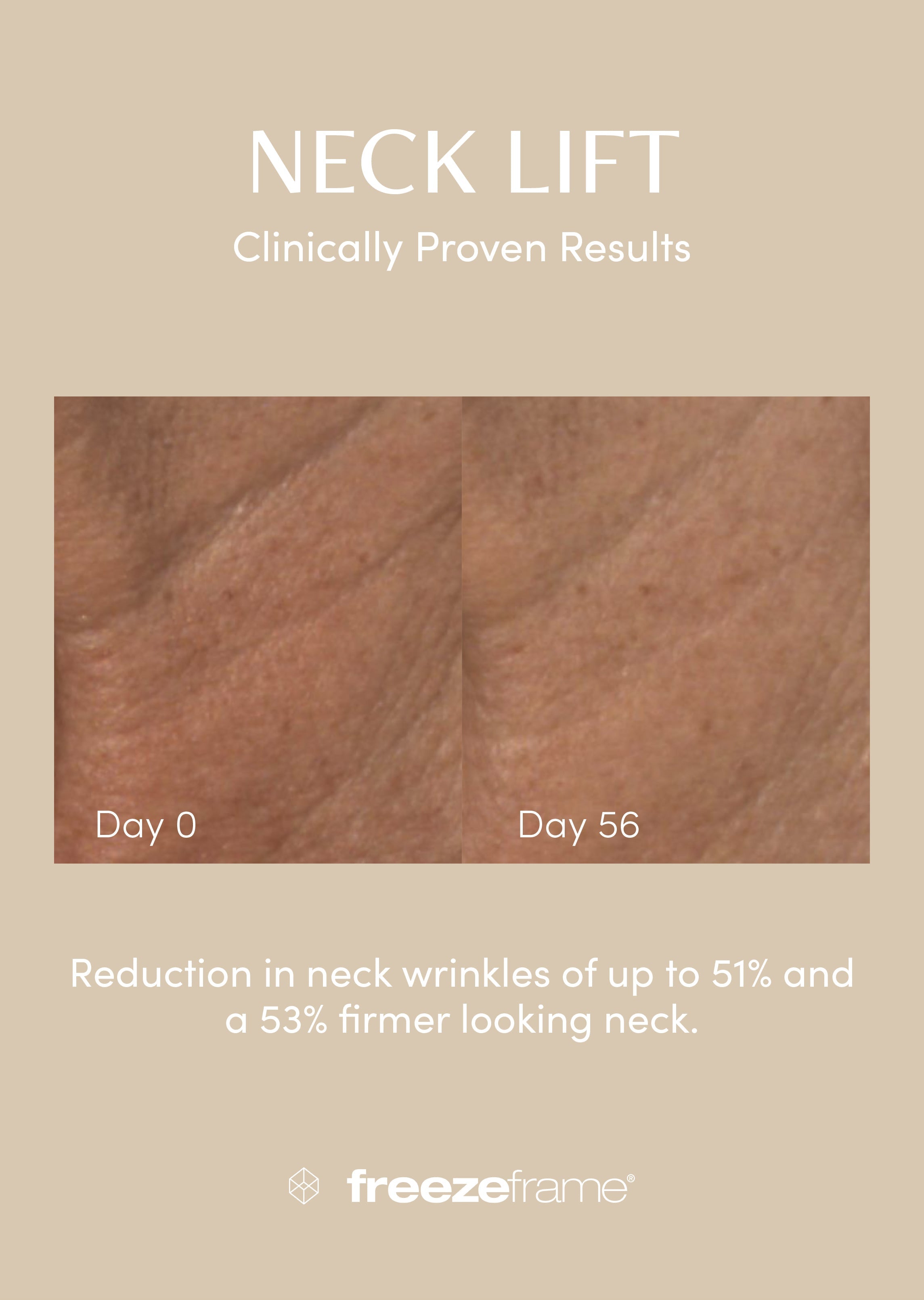 NECK LIFT Freezeframe