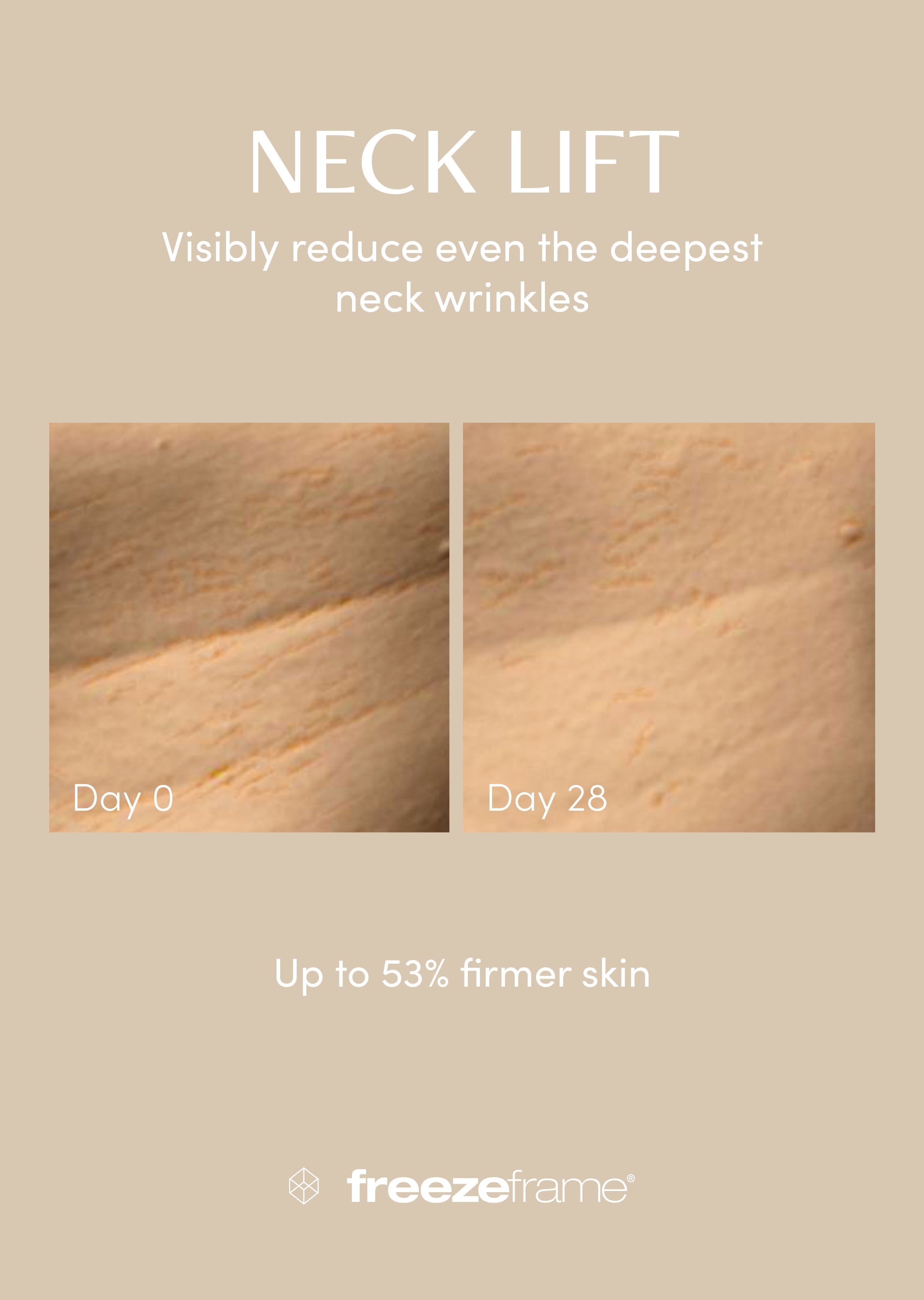 NECK LIFT Freezeframe
