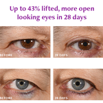Total Eye Repair Bundle Freezeframe