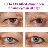 Total Eye Repair Bundle Freezeframe