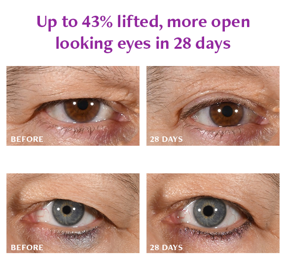 Total Eye Repair Bundle Freezeframe