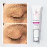 FACE LIFT & REJUVENATION SYSTEM freezeframe
