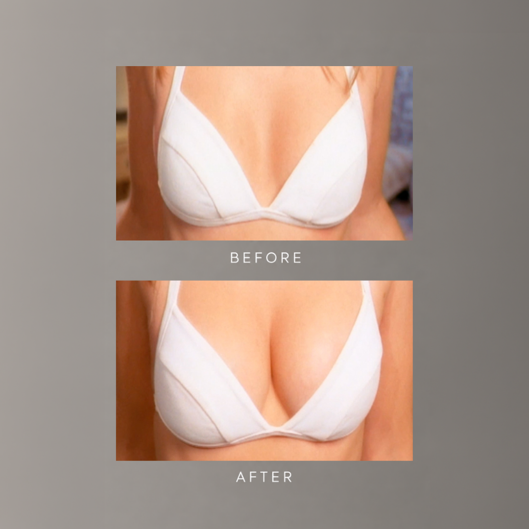 freezeframe BREAST ENHANCER before and after comparison showing a woman wearing a white bra, with visibly fuller, more lifted-looking breasts and enhanced cleavage in the after image.