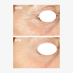 freezeframe PRO-COLLAGEN SUNCEUTICAL before and after comparison showing the eye area with visibly smoother skin and reduced appearance of crow's feet, fine lines and wrinkles.