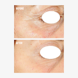 freezeframe PRO-COLLAGEN SUNCEUTICAL before and after comparison showing the eye area with visibly smoother skin and reduced appearance of crow's feet, fine lines and wrinkles.
