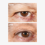 freezeframe non-surgical EYELID LIFT lifting serum before and after results for lifted, more open-looking upper eyelid