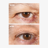 freezeframe non-surgical EYELID LIFT lifting serum before and after results for lifted, more open-looking upper eyelid