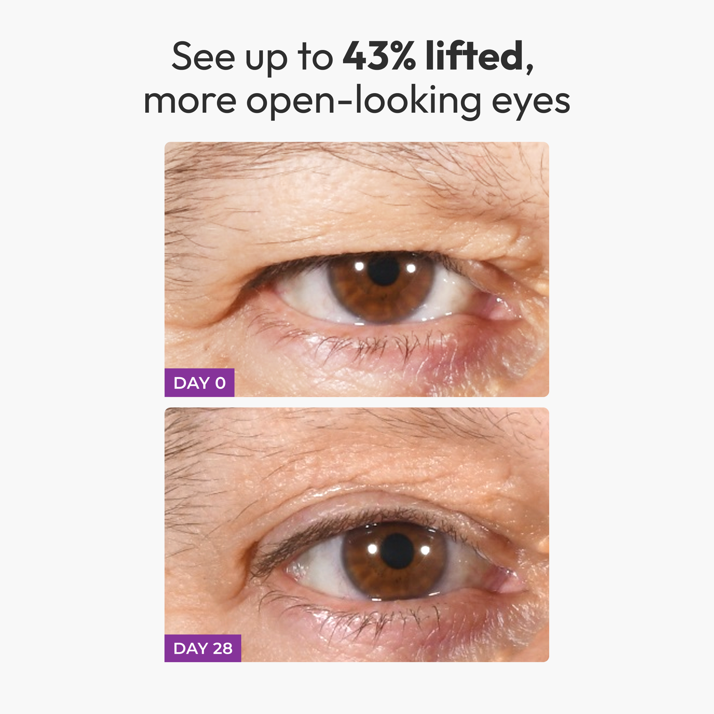 freezeframe EYELID LIFT and REVITALEYES bundle, eyelid lift serum and targeted eye treatment for hooded and drooping eyelids